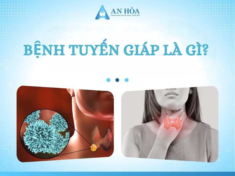 Phương pháp điều trị