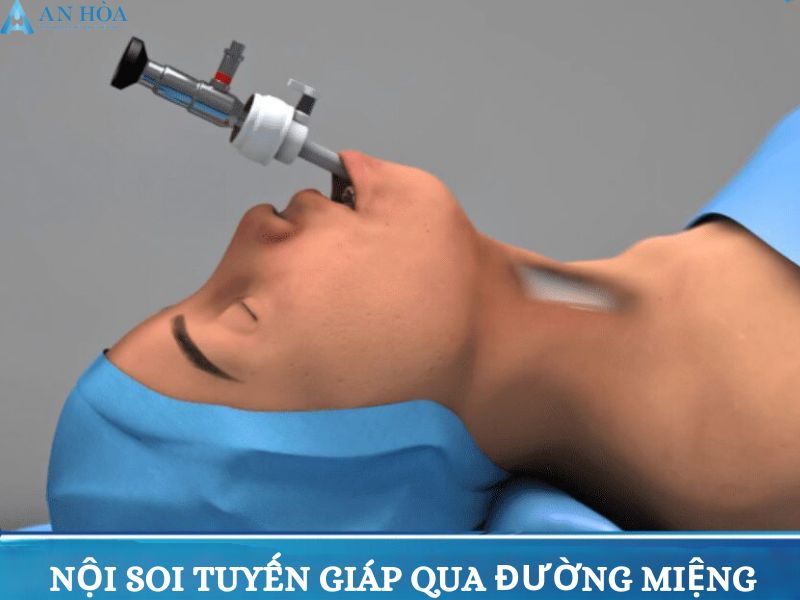 Phương pháp điều trị