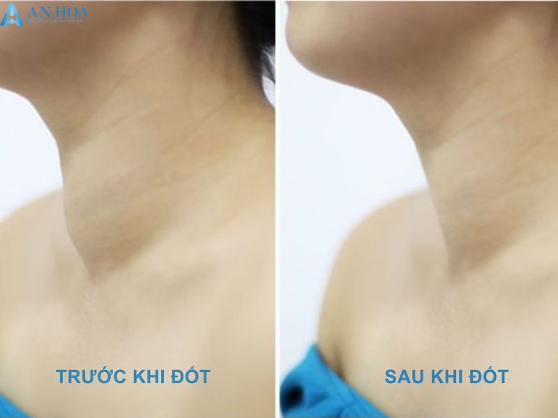 Phương pháp điều trị