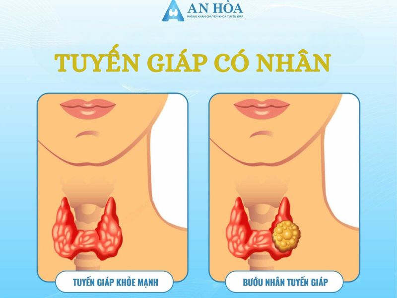 Phương pháp điều trị