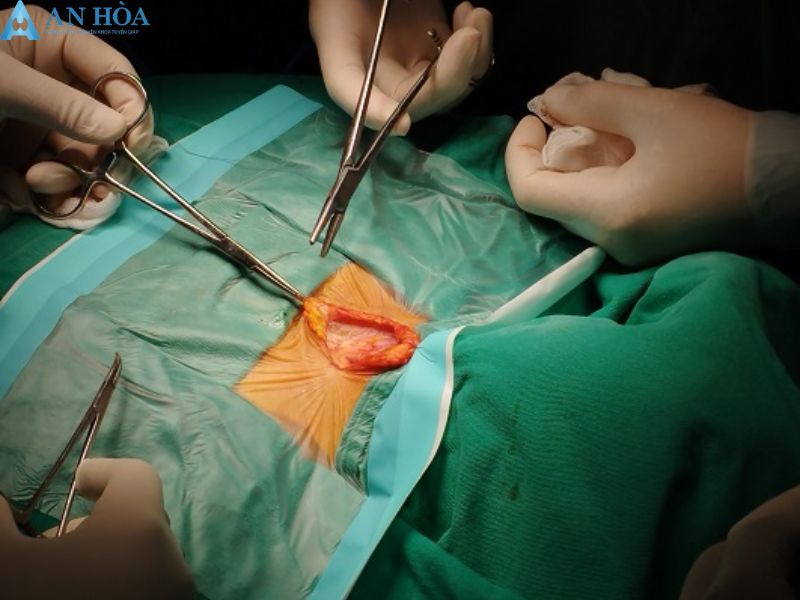 Phương pháp điều trị