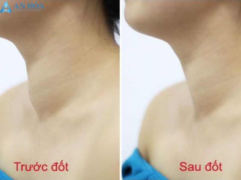 Về chúng tôi An Hòa