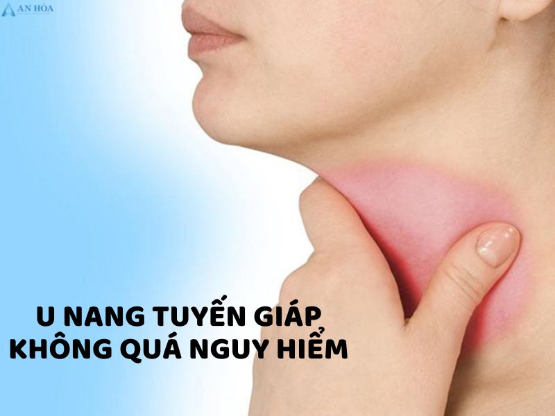 Bị nang tuyến giáp có nguy hiểm không