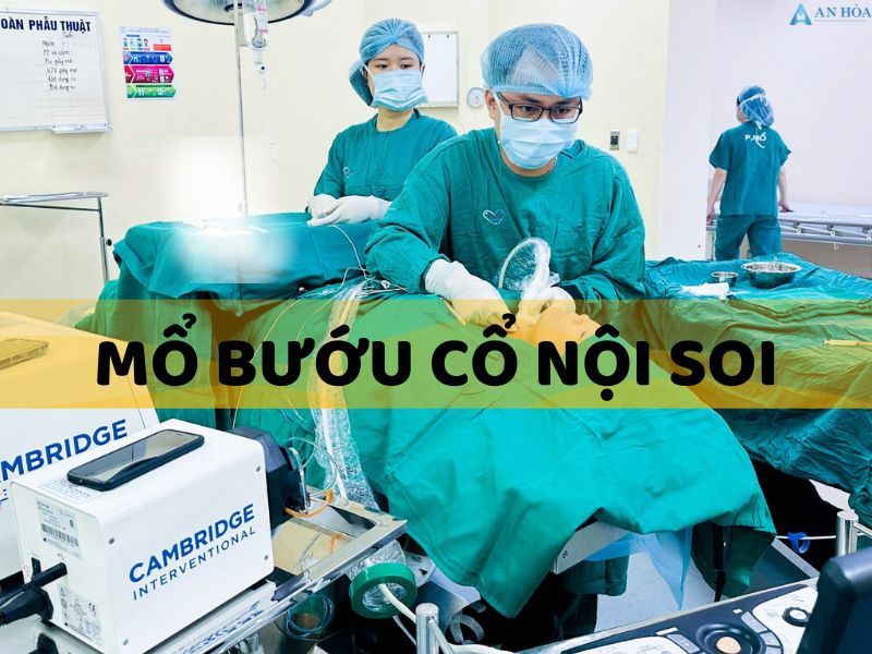 Bướu cổ lành tính có nên mổ không