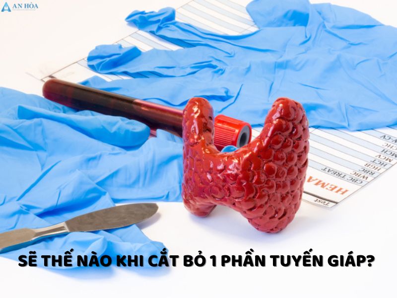 Tuyến giáp nằm ở vị trí nào
