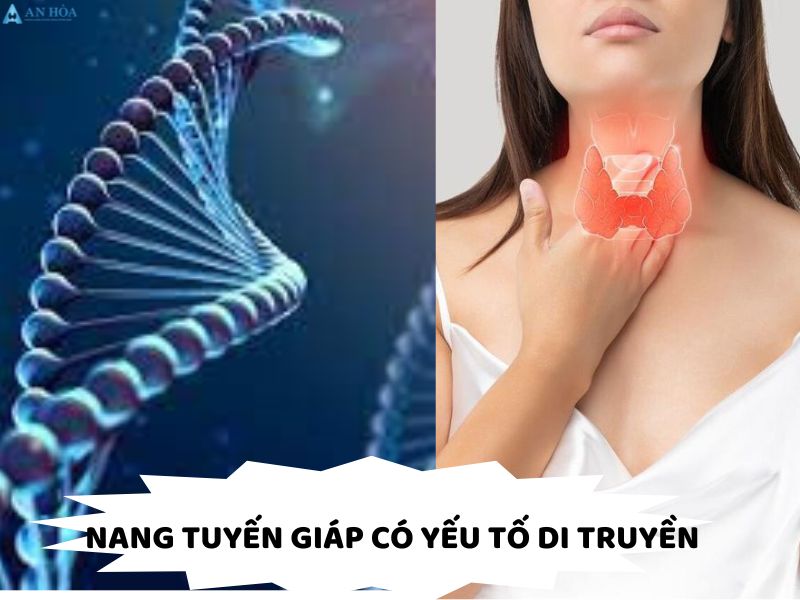 Bị nang tuyến giáp có nguy hiểm không?