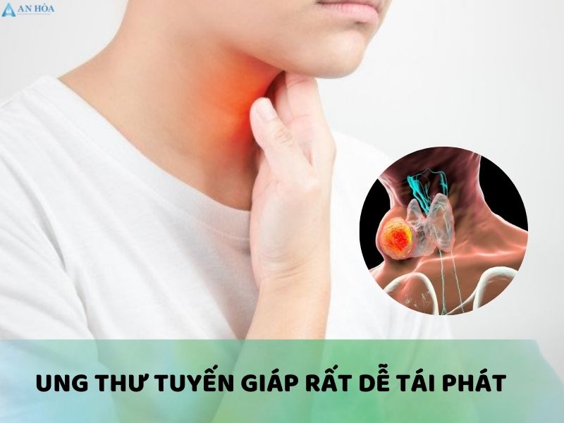 U ác tuyến giáp có phải là ung thư không
