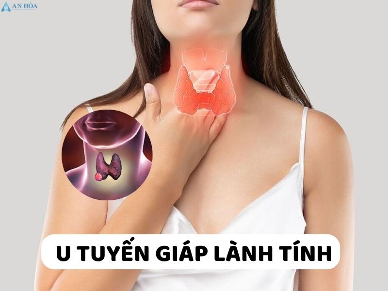 Bị nang tuyến giáp có nguy hiểm không?