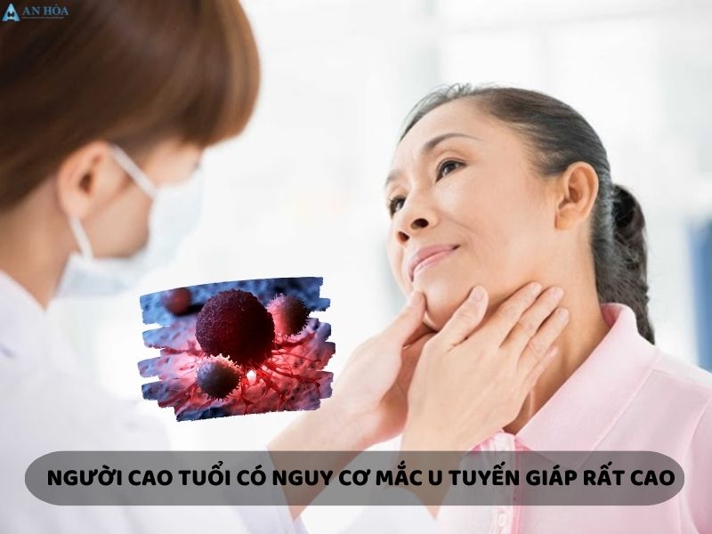 Bị nang tuyến giáp có nguy hiểm không?