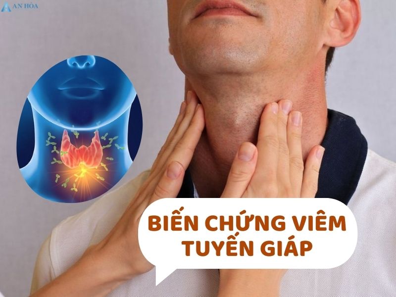 Viêm tuyến giáp có nguy hiểm không