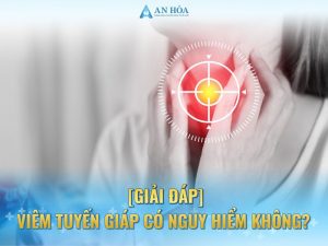 Viêm tuyến giáp có nguy hiểm không